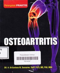 OSTEOARTRITIS